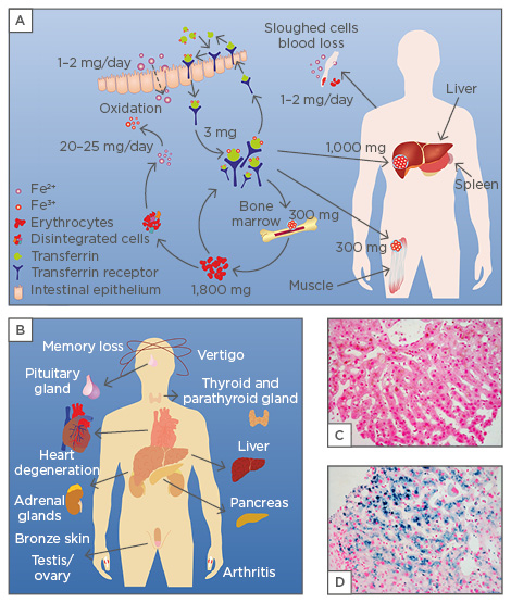 Iron recycling and distribution in the body. Body iron is