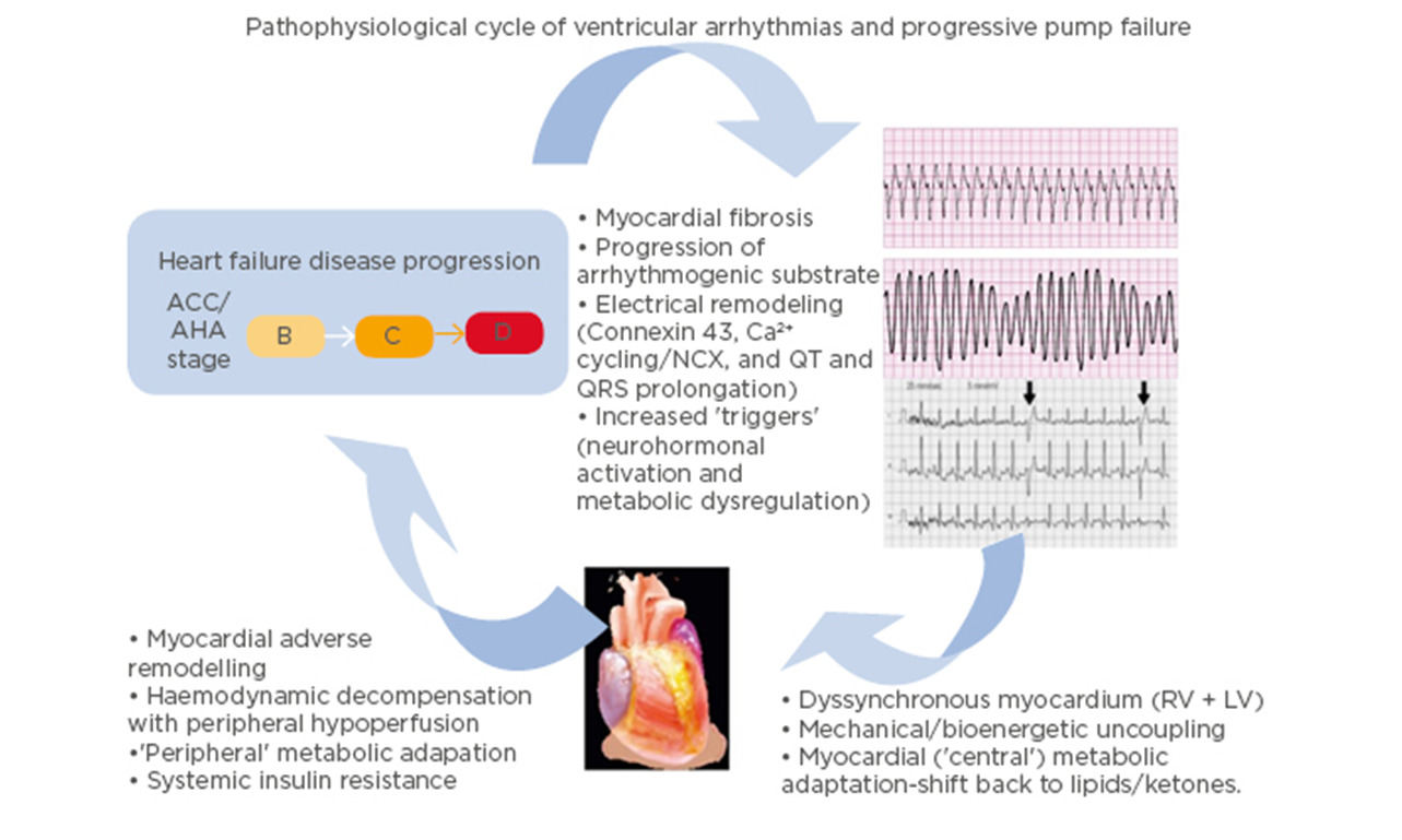 How is Sudden Cardiac Dysfunction (SCD) different from a heart attack?