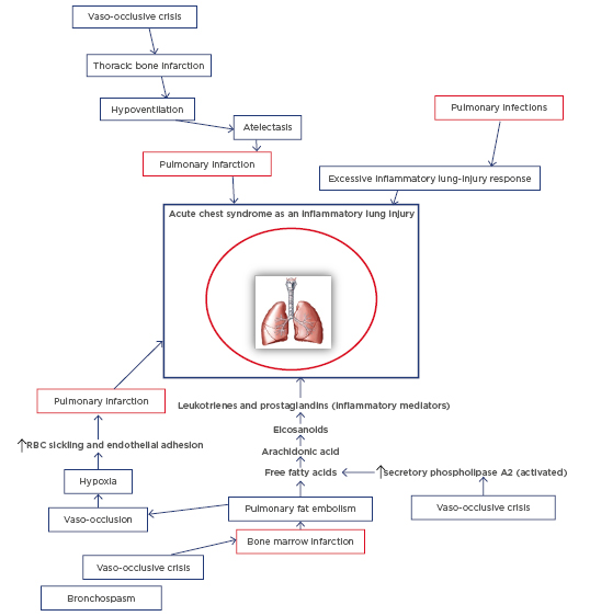 Figure 1: Schematic diagram of the pathogenesis of acute chest syndrome.
