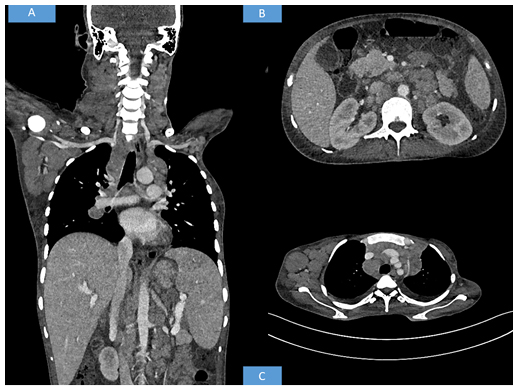 Figure 1: Radiological findings