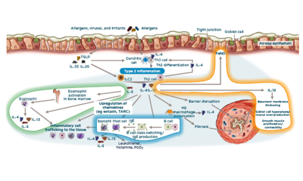 IL-4/13 and IL-5 are key cytokines