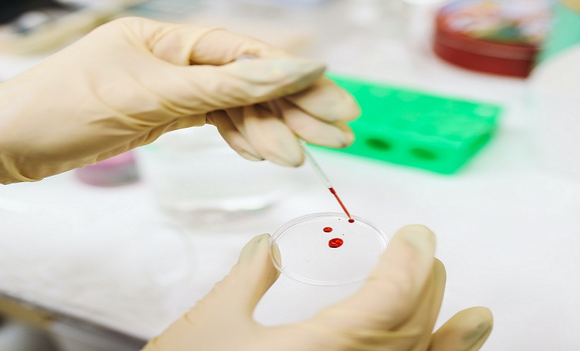 Novel Blood Test to Predict Liver Cancer