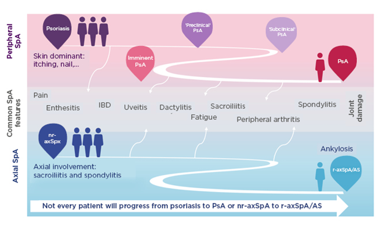 ASDAS Is More Important Than BASDAI in Advanced Ankylosing Spondylitis -  ACR Meeting Abstracts