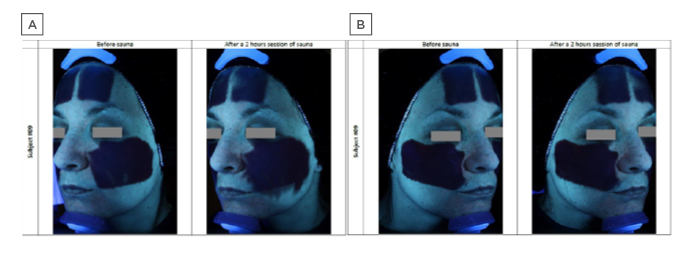 Figure 2 Comparative sunscreen stability under conditions of extreme heat and humidity, visualised with