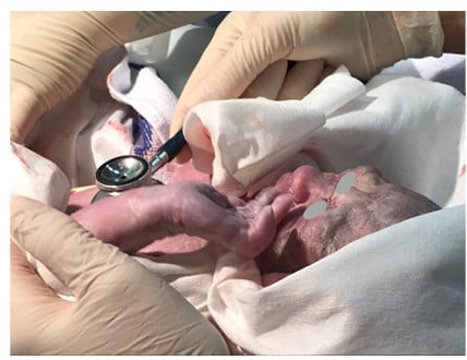 Figure 1 Vernix caseosa covering the skin of a newborn