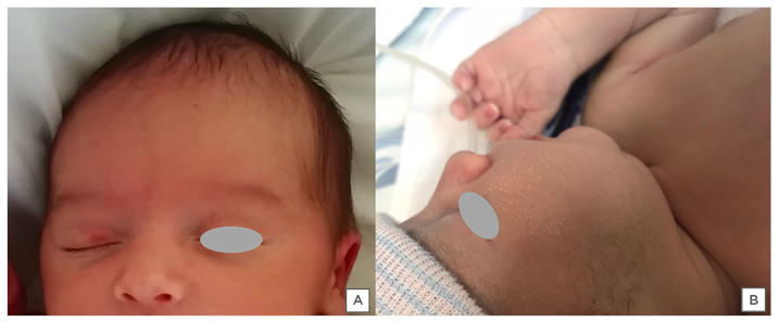 Figure 2 Physiological alterations