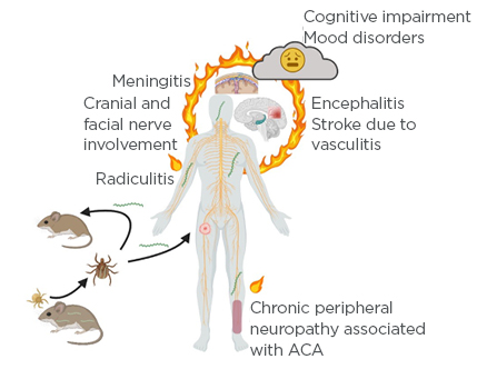 Figure 1 Borrelia life cycle and development of Lyme neuroborreliosis