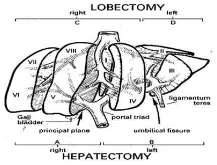 Figure 1 Couinaud’s segmental anatomy of the liver (with permission Weledji et al. Curr Surg Rep 2016;44).16