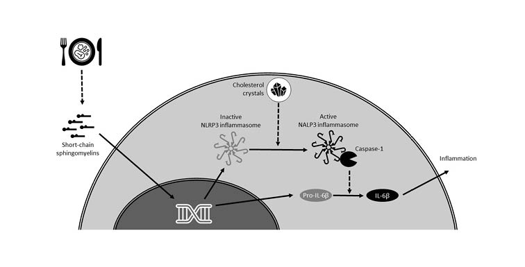 Figure 2 Putative role of a Western diet on inflammation in atherosclerosis