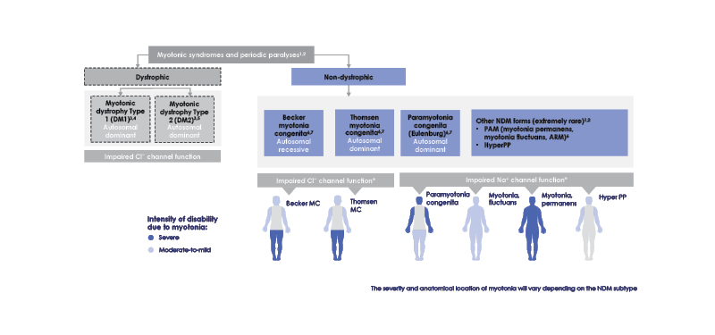 Figure 1 Non-dystrophic myotonia subtypes.