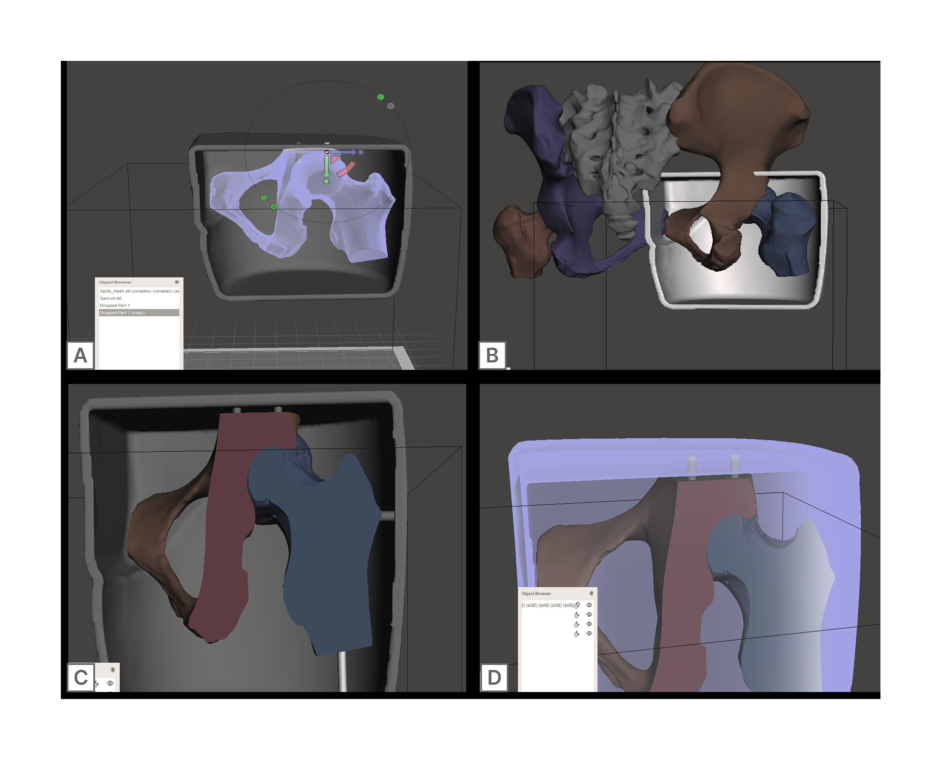Figure 1: Computer generated designs to create a realistic 3D printed hip phantom.