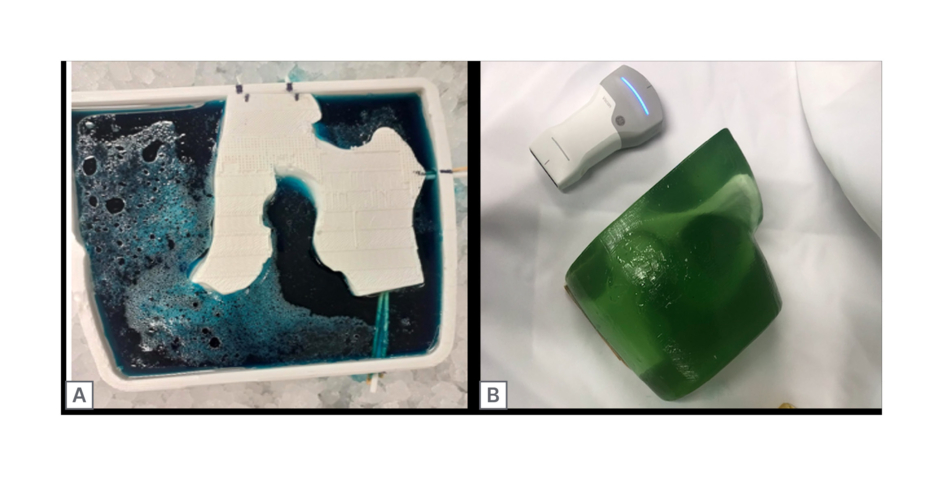 Figure 2: Poured and final prototype of ultrasound hip phantom.