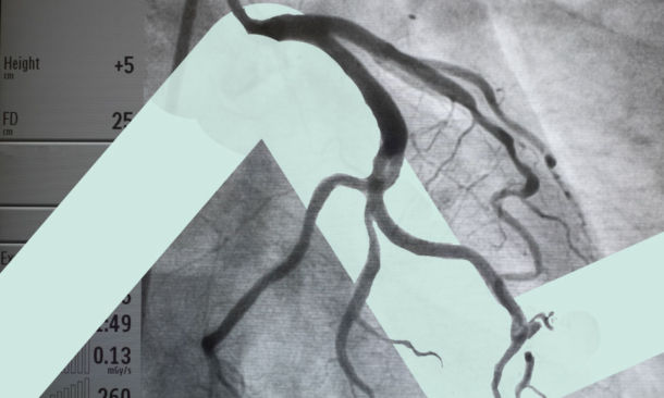 Coronary angiography