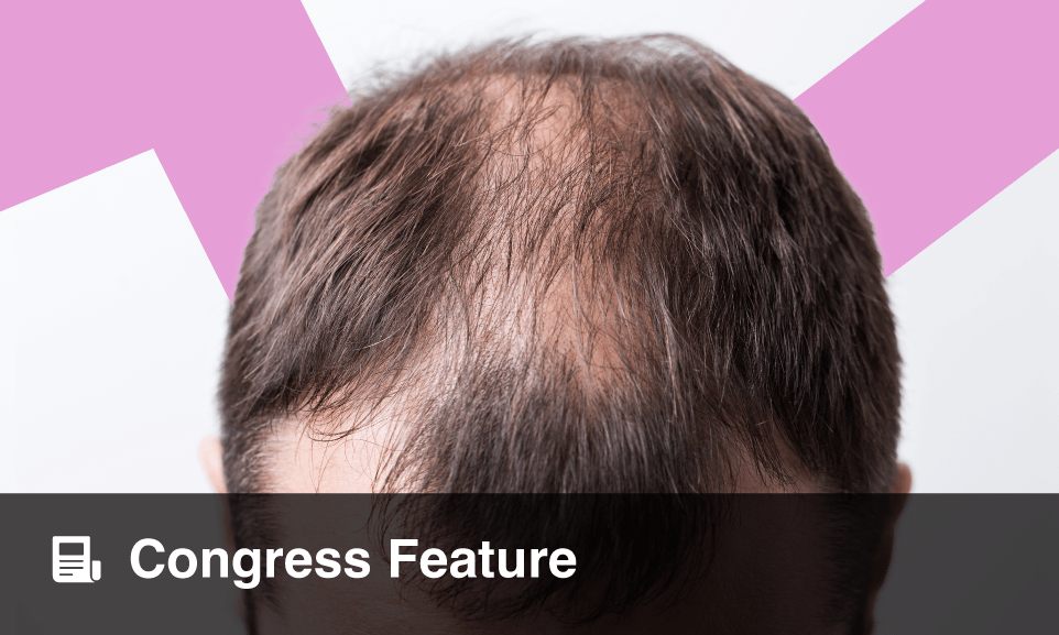 Scarring Alopecia CuttingEdge Approaches European Medical Journal