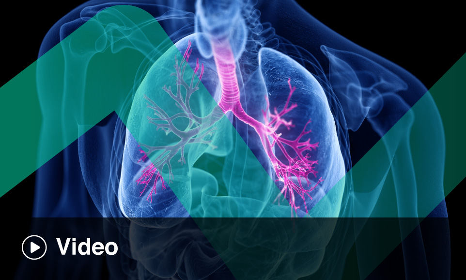 Finding the Right Balance - Choosing an ICS/LABA for Moderate Asthma ...