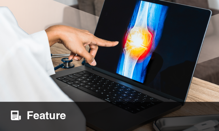 Point of Care Ultrasound (POCUS) in Rheumatology - European Medical Journal