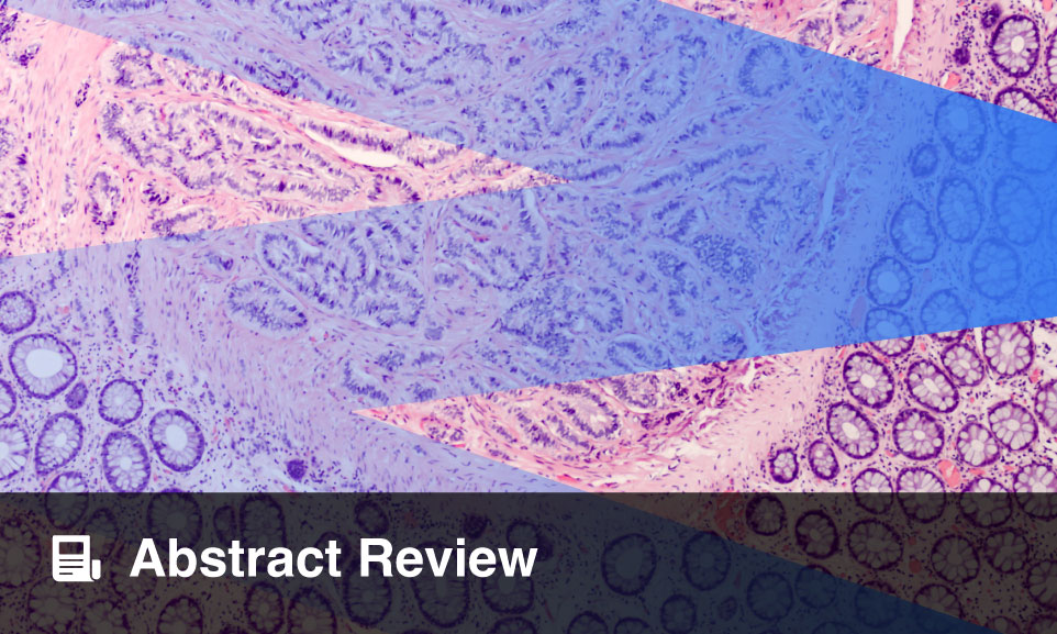 Targeting DLL3 in Rare Neuroendocrine Carcinoma: Early Results and ...