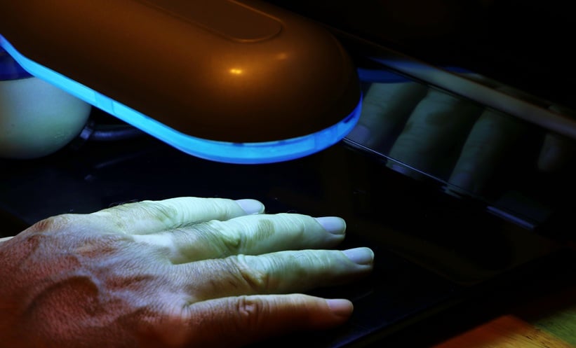 Psoriasis Treatment Response Restored With NB-UVB