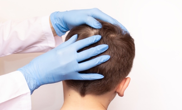 Child scalp exam illustrating tinea capitis risk factors and nutritional deficiencies