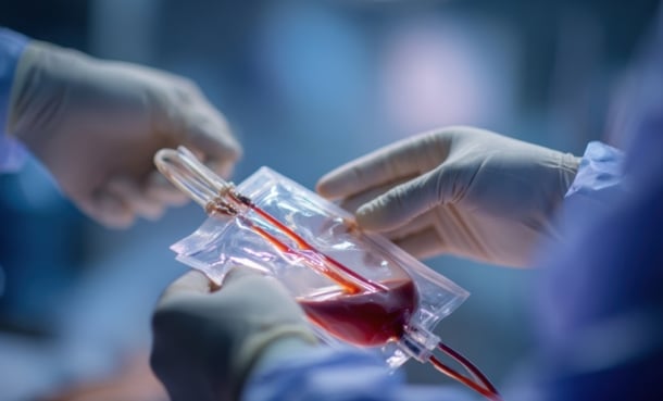 Alzheimer’s progression