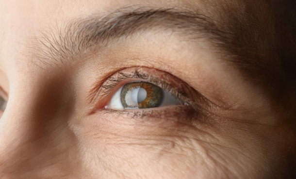 Tirzepatide and Reduced Glaucoma Risk in Diabetes - EMJ