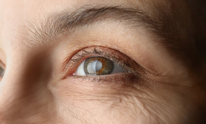 Tirzepatide and Reduced Glaucoma Risk in Diabetes - EMJ
