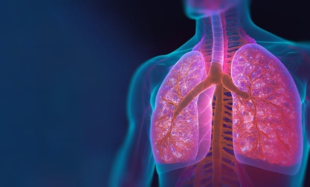 Lung Cancer Risk Rises with Prior Lung Disease