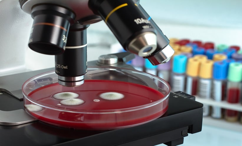 Laboratory testing for fungal infections in community-acquired pneumonia