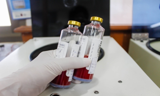 Blood culture bottles in a microbiology lab representing Streptococcus agalactiae bacteremia and time to positivity