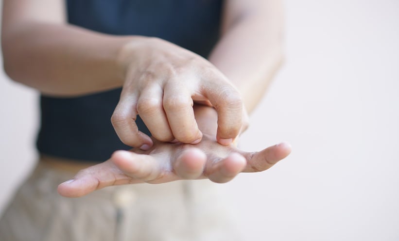 Person scratching an itchy palm, representing plaque psoriasis itching and skin inflammation