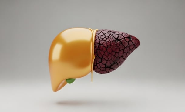 Hepatitis-associated aplastic anaemia