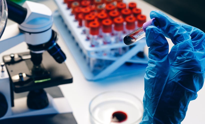 New Blood Test Identifies Serious Scarring in Liver Disease - EMJ