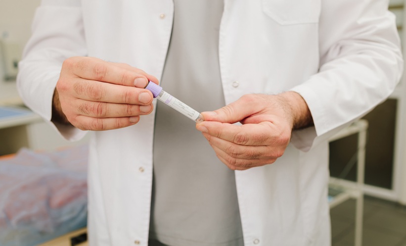 Low Midlife PSA Linked to Reduced 20-Year Prostate Cancer Risk