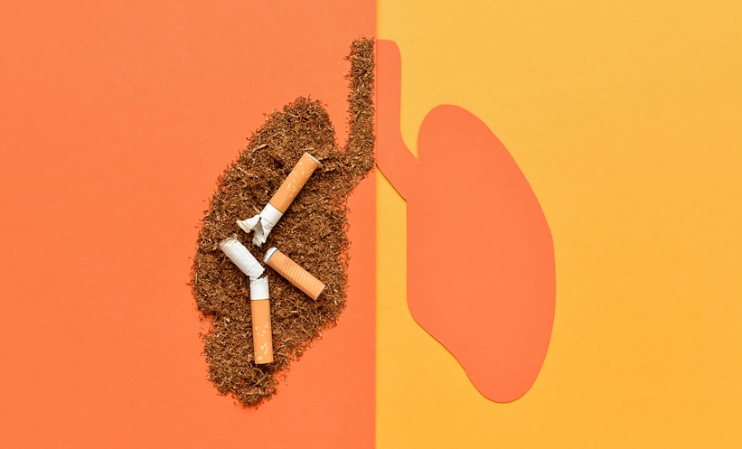lung cancer in never smokers