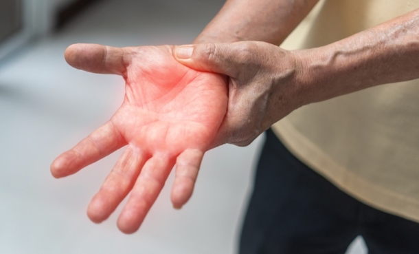 Self-Management Intervention Targets Early Inflammatory Arthritis