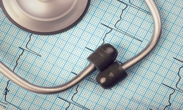 iron bioresorbable scaffold