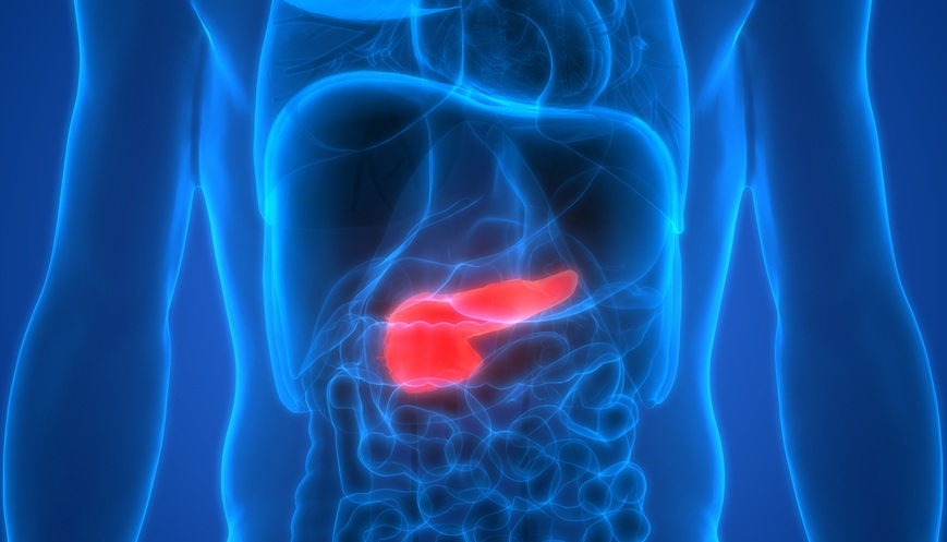 Acute Pancreatitis Warnings Strengthened on GLP-1RAs