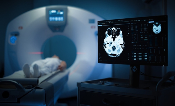 MRIs Reveal Brain Changes After Second Pregnancy - EMJ