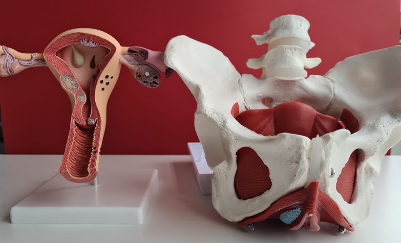 endometriosis-specific MRI templates