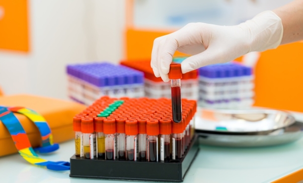 Oral glucose tolerance test blood draw for cystic fibrosis-related diabetes biomarker research