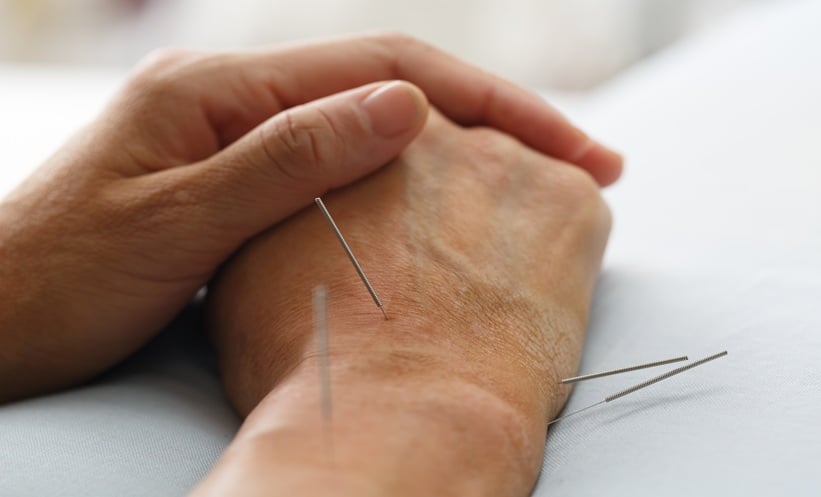 Close-up of acupuncture needles inserted into the hands during a manual acupuncture treatment session.