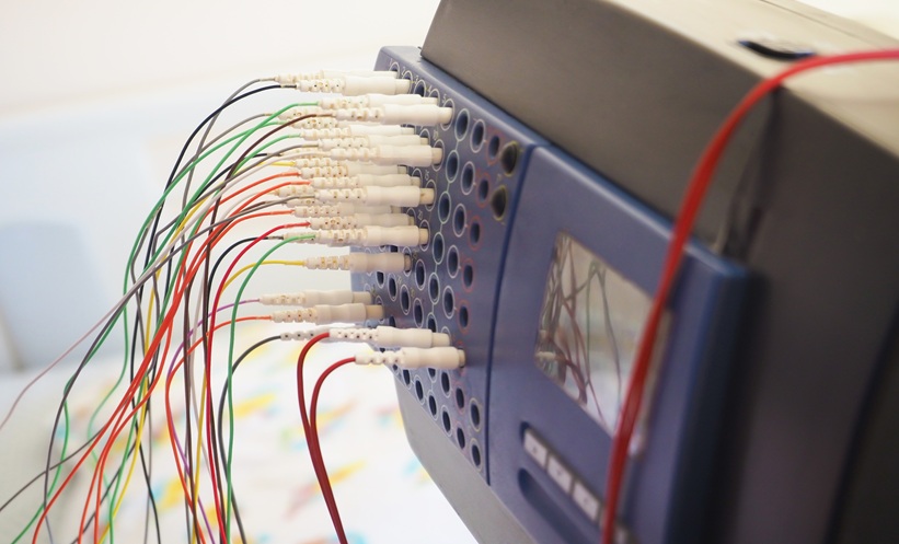 Patient undergoing overnight sleep study for obesity hypoventilation syndrome treatment evaluation.