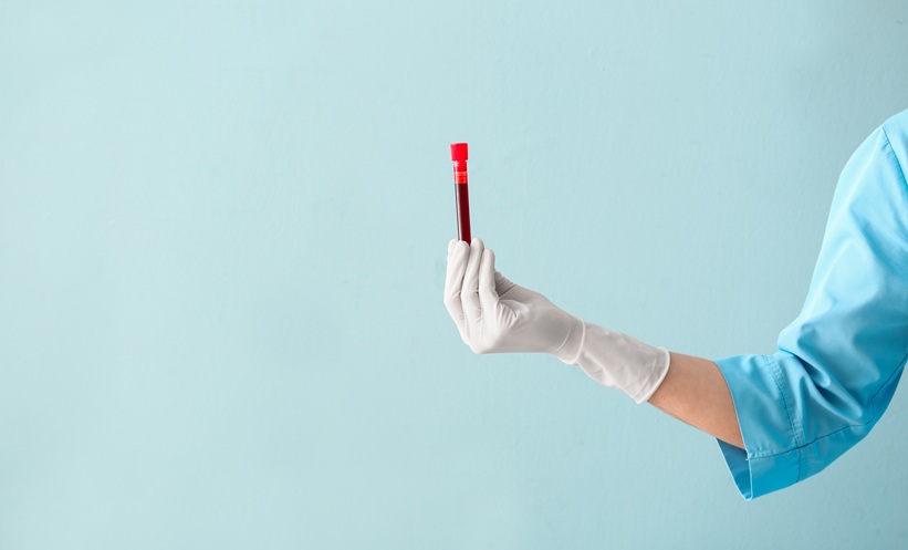 Multicancer Detection with Single Blood Test - EMJ