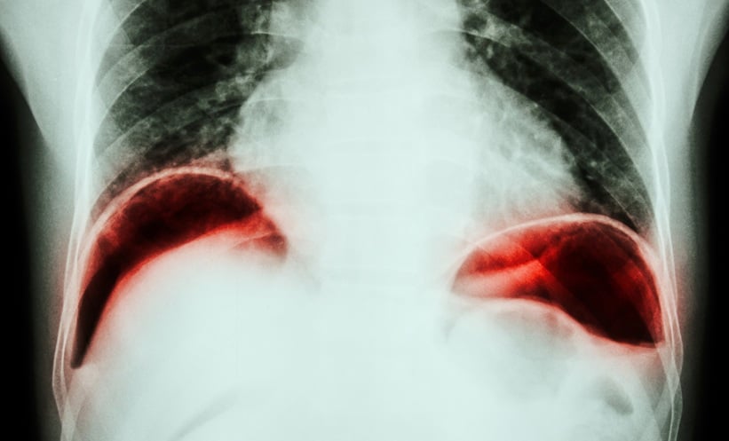 Novel Acid-Tolerant Bioadhesive for Gastric Perforation