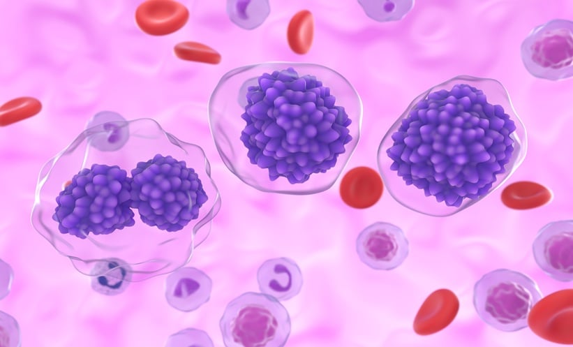 CAR-T Therapy Outcomes Linked to Lymphocyte Growth - EMJ