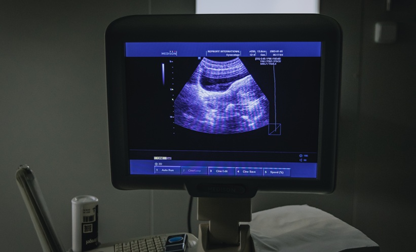 COVID-19 Linked to Changes in Fetal Growth Measurements