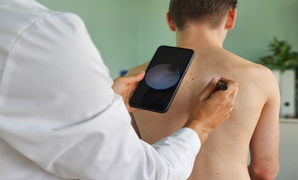Man using a smartphone to assess a patient's skin.