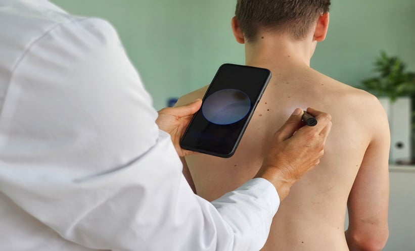 Man using a smartphone to assess a patient's skin.