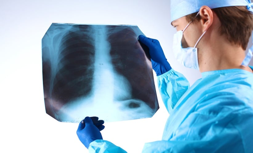 Doctor examining a lung radiography x ray.