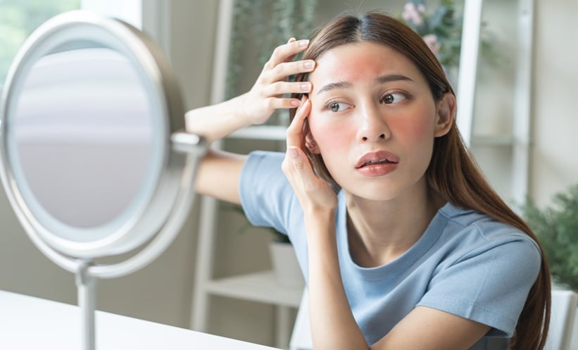 Concerned woman with allergic facial reactions examining her allergies in the mirror.